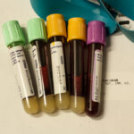 blood cancer treatment