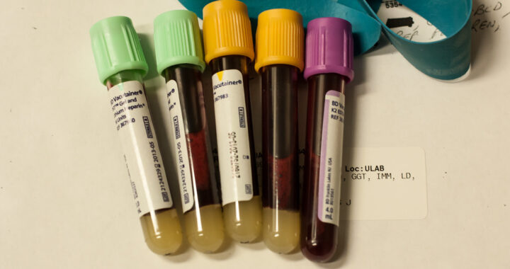 blood cancer treatment
