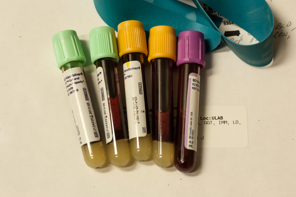 blood cancer treatment